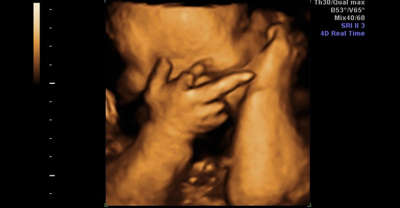 Funny Creepy Ultrasound Pictures