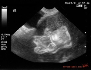 Ultrasound bear hotsell