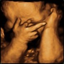 Funny Creepy Ultrasound Pictures